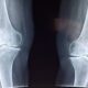<strong>Let’s Talk About Bone Health</strong>